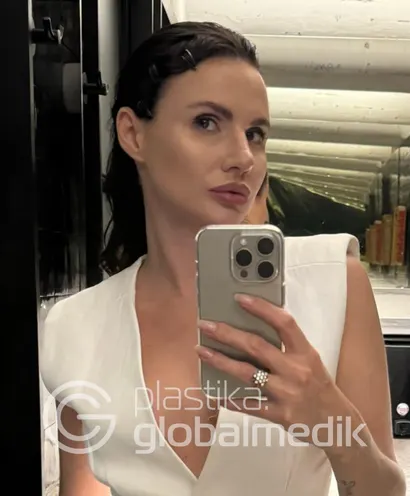 Фото после №6